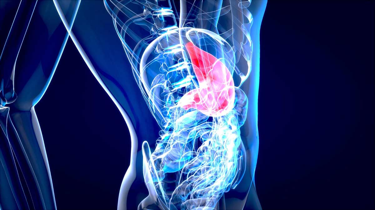 tratamiento-esofago-barrett-tecnica-halo