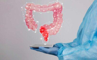 Importancia de la detección temprana en el cáncer de colon