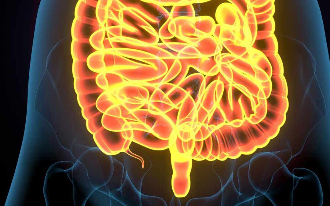 Qué es la diverticulosis: síntomas, diagnóstico y tratamiento