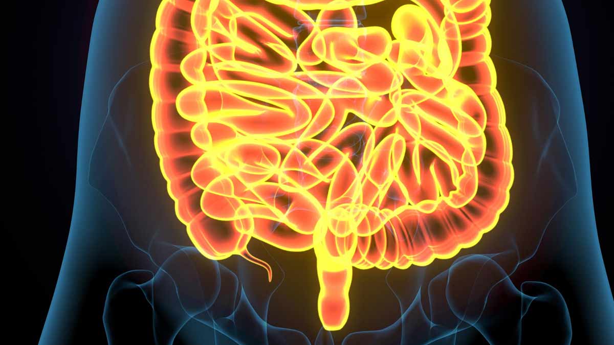 diverticulosis-sintomas-tratamiento