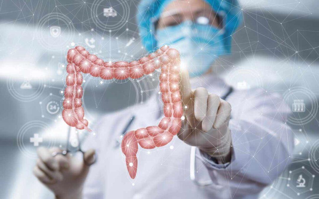 Prevención del cáncer de colon: Estrategias y consejos para una detección temprana