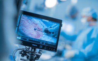 Disección submucosa endoscópica en Barcelona: qué es, cuándo se indica y por qué EndosAdvanced es referencia