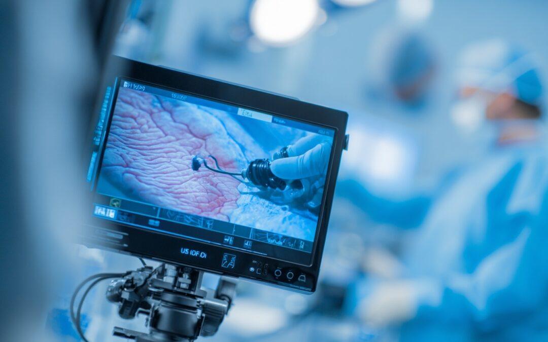 Disección submucosa endoscópica en Barcelona: qué es, cuándo se indica y por qué EndosAdvanced es referencia