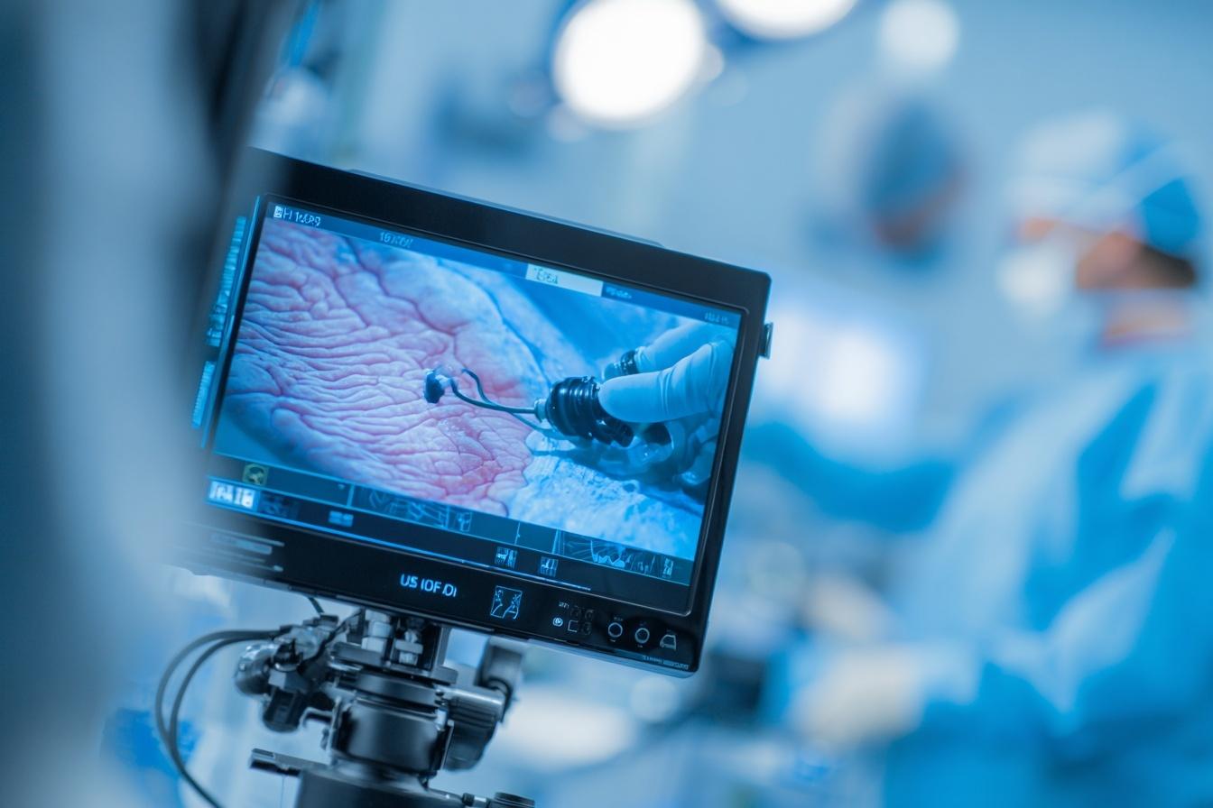 Disección submucosa endoscópica en Barcelona con EndosAdvanced